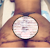 #REPLAYTUNES: Fitness Model Undergoes Surgery To Remove Her Fake Butt Implants.