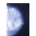 3D Mammograms (Detects 2-7 cancers for every 1000 women screened)