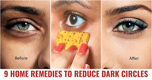Remedies for dark circles