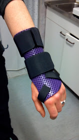 have been told usually Drs would put a non-removable cast on for six -3.bp.blogspot.com
