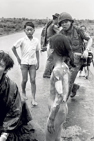 The photo clearly shows the severe burns to the back and arms that Kim Phuc sustained during that conscious napalm bombardment and of which she still bears the scars today.