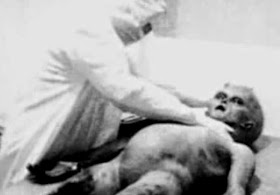 A screen grab from an alleged autopsy video examining the body of an alien found at Roswell UFO crash 1947. The video surfaced in 1990's but but it was later found to be a staged reconstruction of what Ray Santilli, a London-based entrepreneur, claimed was a re-enactment of a older video he had witnessed