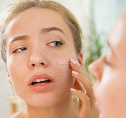Dry Skin Care-What Vitamin Deficiency Cause Dry Skin On Face , Dry Skin:who gets and cause, vitamins for dry skin