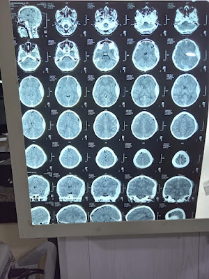 hasil ct scan