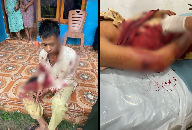 Korban Perampokan dan Penembakan Sadis Desa Sungai Pinang