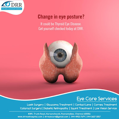 Thyroid eye disease surgery hospital in chennai