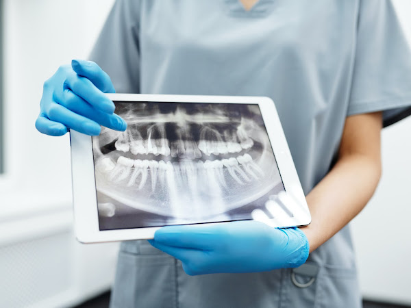 Dental Implants Failure and Rejection: What to Look Out For?