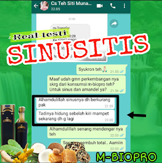 M-Biopro Mengobati Sinusitis