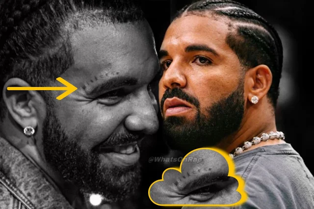 Drake's New "Miskeen" Face Tattoo: Unraveling the Mystery at Nostalgia Party