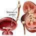 Cara Mencegah Penyakit Batu Ginjal