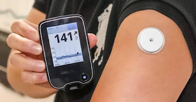 Continuous Glucose Monitoring (CGM) systems are the most recent advancement in diabetes care.