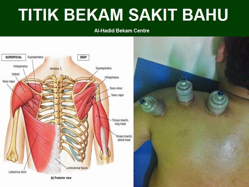 MAKLUMAT KESIHATAN DAN PENYAKIT: TITIK BEKAM