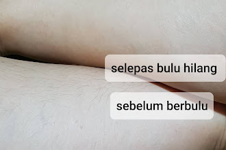 Tips buang Bulu roma di badan dengan Surker (Epilator murah)