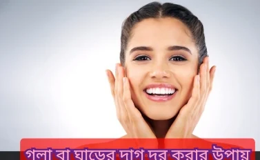 গলা ও ঘাড় ফর্সা করার উপায়