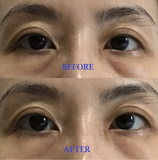 Remescar Eye Bags & Dark Circles Temporary Fix