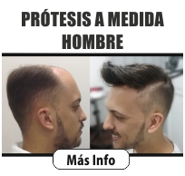 PROTESIS CAPILAR A MEDIDA HOMBRE