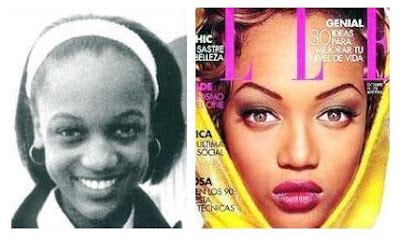 Tyra Banks Plastic Surgery