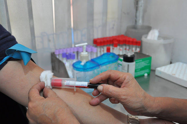Denuncian escasez de reactivos para pruebas de VIH en Venezuela