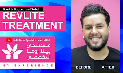 RevLite Treatment | Revlite Procedure Bella Roma Dubai | علاج الريفلايت