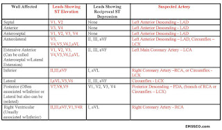   ekg คือ, ekg ผิดปกติ, ekg 12 lead ปกติ, normal sinus rhythm คือ, basic ekg, p wave คือ, การติด ekg monitor, กราฟคลื่นหัวใจผิดปกติ, ekg ย่อมาจาก