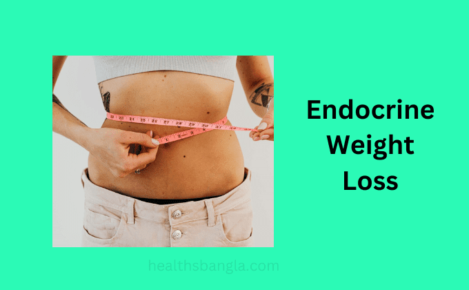 Endocrine-Weight-Loss