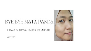 bebas mata panda berkat skincare aye cream dr. hen mata panda hilang