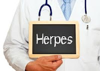 penyakit kulit herpes