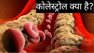 कोलेस्ट्रॉल क्या होता है//कोलेस्ट्रॉल कैसे बढ़ता है cholesterol kya hota hai