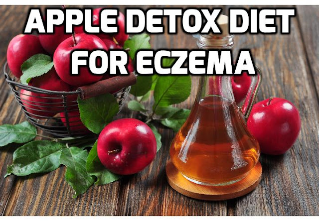 Do you know that apple detox can increase the effectiveness of your eczema treatment? Read on to find out how you can start this apple detox program to prevent future eczema breakouts.