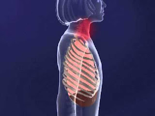   intercostal retractions, intercostal retractions ards, intercostal retractions treatment, intercostal recession definition, intercostal retractions causes, substernal retraction, intercostal retractions newborn, intercostal retractions in adults, intercostal retractions toddler