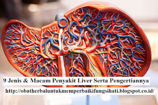 9 Jenis & Macam Penyakit Liver Serta Pengertiannya