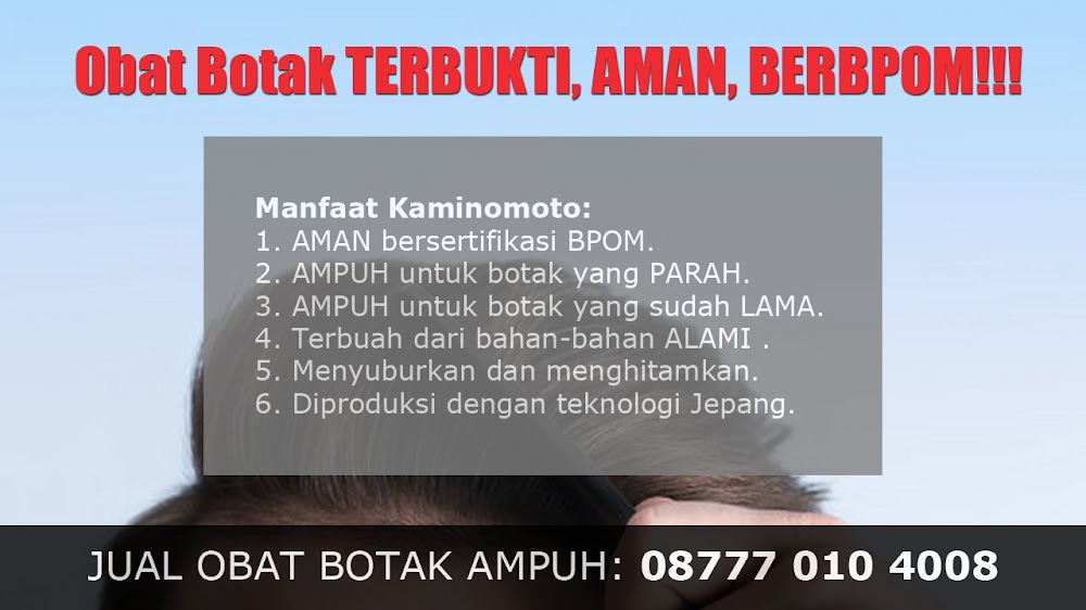 jual OBAT PENUMBUH RAMBUT BOTAK Purwodadi<br/>