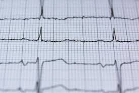 Five subtle signs that you may be at risk of heart disease