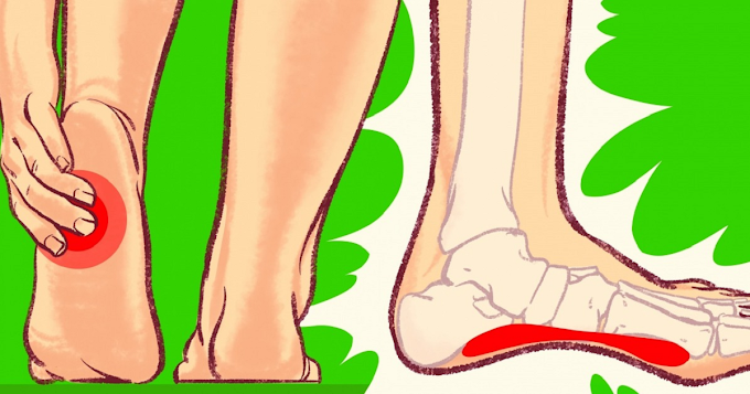 ခြေဖနောင့်အတက်ထွက်ခြင်းကို သက်သာပျောက်ကင်းစေမယ့် ထိရောက်တဲ့နည်းလမ်း (၉) ခု