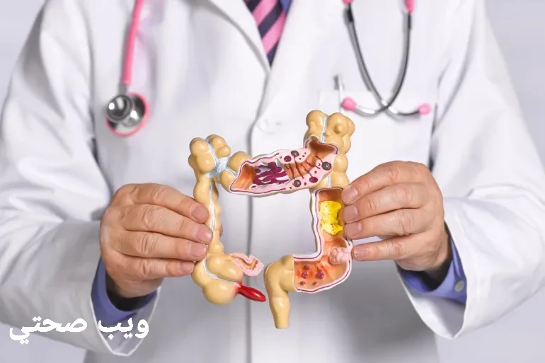 القولون .. عليك بالبكتيريا النافعة والصيام الطويل وقلل الاوراق الخضراء الثقيله