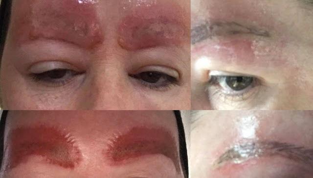  Mujer advierte de las consecuencias de tatuarse las cejas 