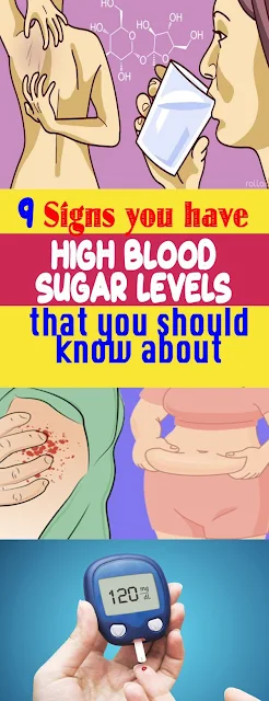 9 Signs, You Have High Blood Sugar