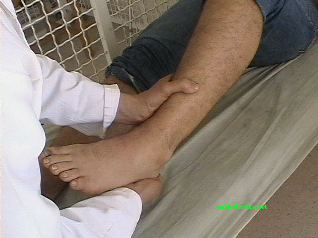 Examen clinique du pied et de la cheville