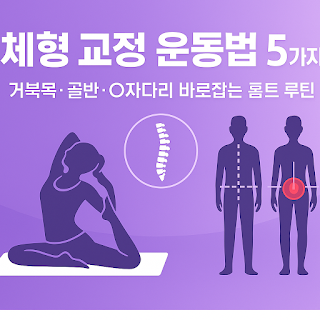 체형 교정을 위한 운동법 5가지｜거북목·골반틀어짐·O자다리까지 자세 바로잡기