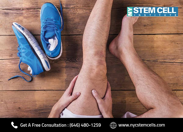 Arthritis Treatment at NYC Stem Cell Institute