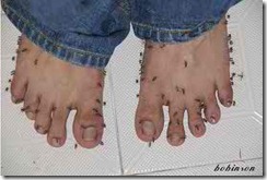 mosquito toes