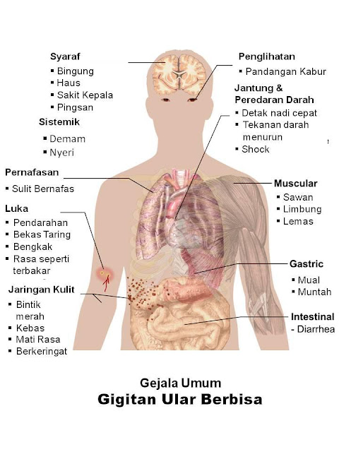 Gejala Umum Akibat Gigitan Ular Berbisa