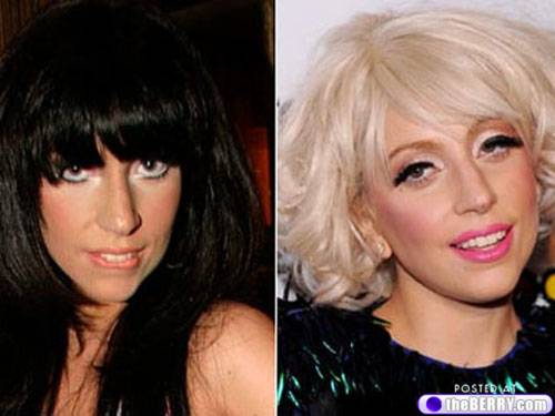 lady gaga before and after nose. megan fox nose job efore and