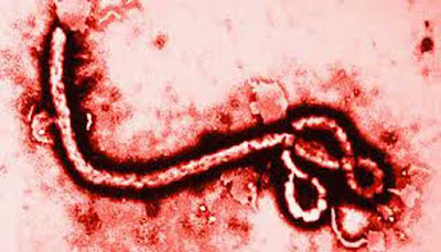 Ebola