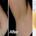 REMOVING UNDERARM HAIR IN JUST 2 MINUTES