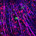 Mejoras en los trasplantes retinianos abren nuevas vías para tratar la pérdida de visión