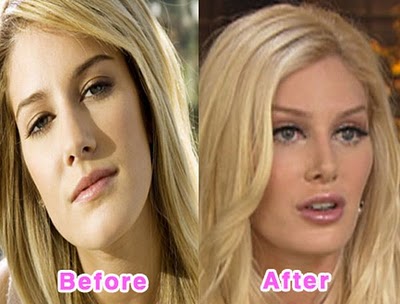 heidi montag before. heidi montag before and after. heidi montag before and after; heidi montag before and after. happydude. Oct 7, 02:24 PM. Of course Android might surpass the