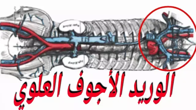 اسباب متلازمة الوريد الاجوف العلوي