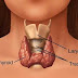 Hyperthyroidism - Assessment and Nursing Diagnosis