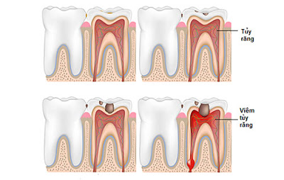 Phân tích niềng răng có ảnh hưởng gì không từ nha sĩ-1